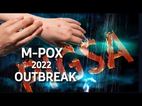 Monkeypox Outbreak, Pigsang kumakalat sa boung mundo (Revelation 16:1-2)