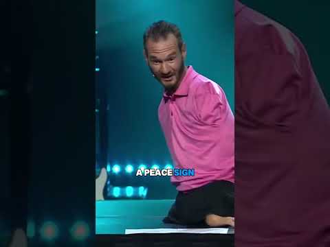 You don’t need arms and legs to love deeply!