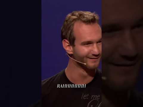 A little girl once mistook Nick for an alien—and instead of getting upset, he made her laugh.