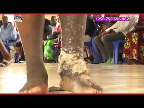 Luke 5:12-13.may the good Lord take away your deproach