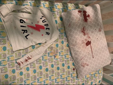 Devotional Thought: A Bloody Mess. Genesis 3:14-19; Leviticus 17:11; Hebrews 9:22